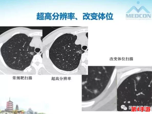 红桃ct：新研究显示红桃ct在早期癌症筛查中的潜力，引发医学界广泛关注与讨论